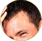Mumbai based plastic surgeon for Hair Transplantation